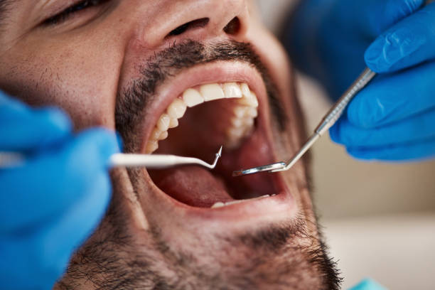 Best Urgent Care for Lost Fillings or Crowns in Linwood, PA